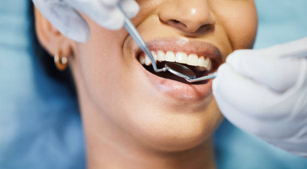 Best Emergency Dentist for Lost Fillings or Crowns in Nicholson, GA