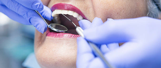 Best Broken or Cracked Tooth Emergency Dentist in Nicholson, GA